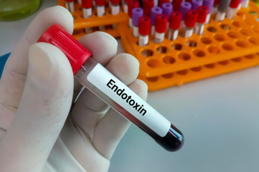 كيفية حساب الحد الأقصى للاندوتوكسين (Endotoxin Limit)؟ كيفية حساب الحد الأقصى للاندوتوكسين (Endotoxin Limit)؟