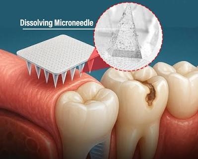 رقعات دوائية قادرة تحفيز نمو الاسنان